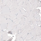 Immunohistochemical staining of human skeletal muscle shows no positivity in myocytes as expected.