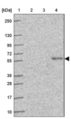 Lane 1: Marker [kDa] 250, 130, 95, 72, 55, 36, 28, 17, 10_br/_Lane 2: Human cell line RT-4_br/_Lane 3: Human cell line U-251MG sp_br/_Lane 4: Human plasma (IgG/HSA depleted)
