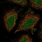 Anti-CCDC122 Antibody