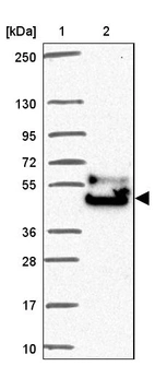 Lane 1: Marker [kDa] 250, 130, 95, 72, 55, 36, 28, 17, 10_br/_Lane 2: Human cell line RT-4