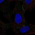 Anti-DPPA5 Antibody