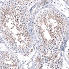 Immunohistochemical staining of human testis shows moderate membranous positivity in cells in seminiferous ducts.