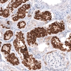 Immunohistochemical staining of human kidney shows strong apical membrane positivity in cells in proximal tubules.