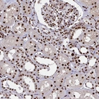 Anti-ZNF607 Antibody