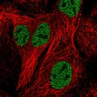 Immunofluorescent staining of human cell line CACO-2 shows localization to nucleoplasm.