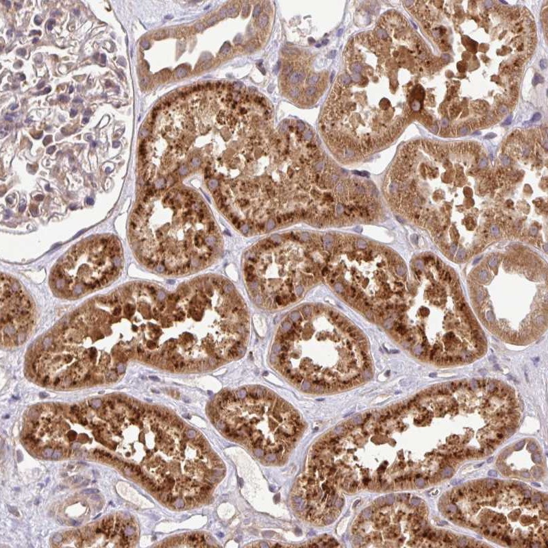 Anti-UBE4A Antibody