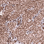 Anti-FOXL2 Antibody