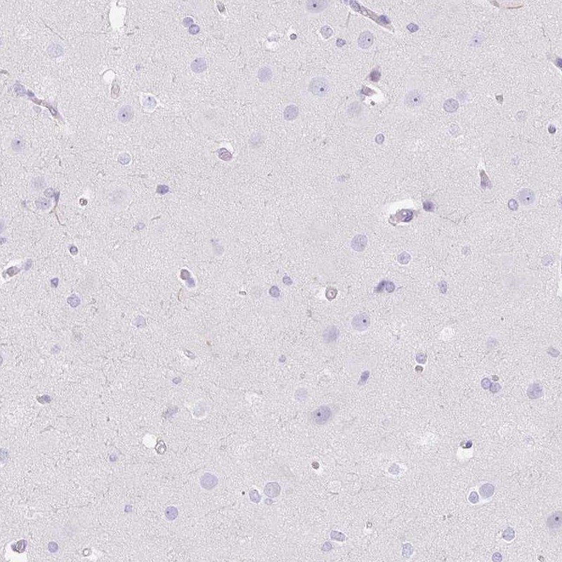 Anti-DCAF17 Antibody