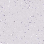 Anti-DCAF17 Antibody