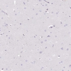 Anti-DCAF17 Antibody
