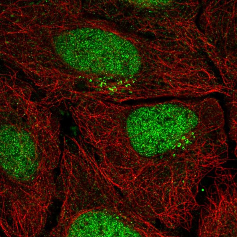 Anti-PPP1R1C Antibody