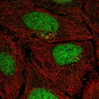 Anti-PPP1R1C Antibody