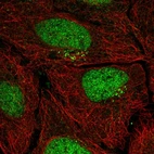 Anti-PPP1R1C Antibody