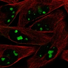 Immunofluorescent staining of human cell line RH-30 shows localization to nucleoli.