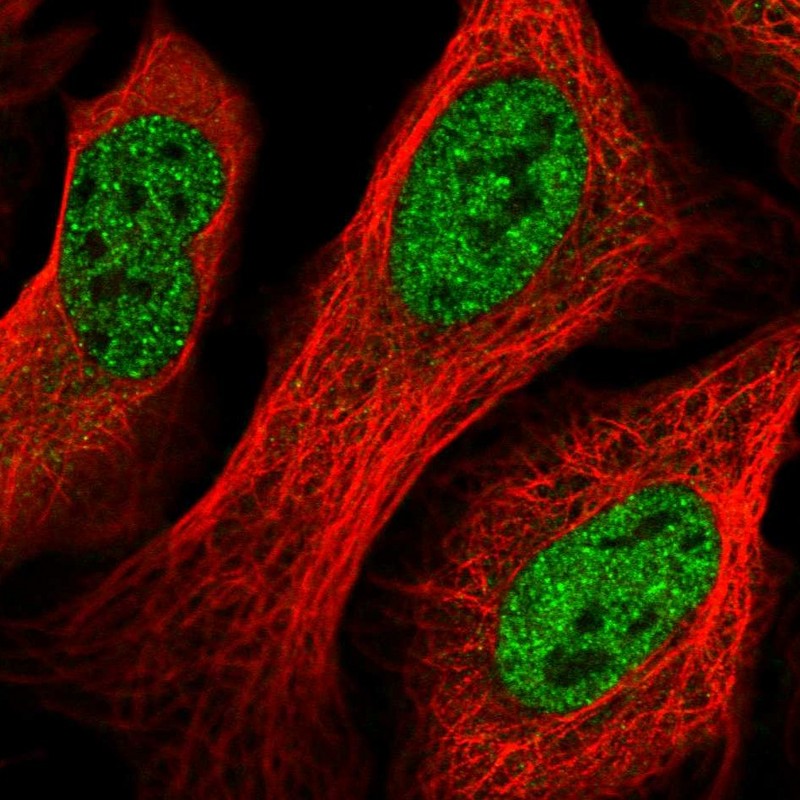Anti-GID8 Antibody