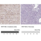 Anti-WNT10B Antibody