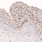 Immunohistochemical staining of human ovary shows moderate to strong nuclear positivity in follicle (granulosa) cells.
