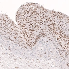 Immunohistochemical staining of human ovary shows moderate to strong nuclear positivity in follicle (granulosa) cells.