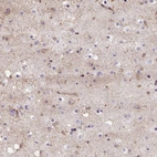 Immunohistochemical staining of human cerebral cortex shows high expression.