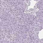 Immunohistochemical staining of human pancreas shows low expression as expected.