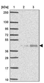Lane 1: Marker [kDa] 250, 130, 95, 72, 55, 36, 28, 17, 10_br/_Lane 2: Human cell line RT-4_br/_Lane 3: Human cell line U-251MG sp