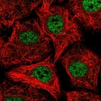 Anti-SOX12 Antibody
