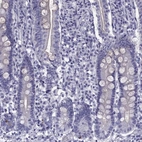 Immunohistochemical staining of human duodenum shows low expression as expected.
