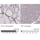 Anti-ATF1 Antibody