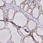 Immunohistochemical staining of human thyroid gland shows high expression.