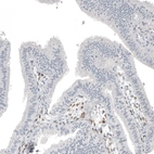 Immunohistochemical staining of human fallopian tube shows moderate nuclear positivity in stromal cells.
