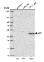 Western blot analysis in U2OS cells transfected with control siRNA, target specific siRNA probe #1 and #2, using Anti-ATF1 antibody. Remaining relative intensity is presented.