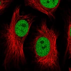 Immunofluorescent staining of human cell line HeLa shows localization to nucleoplasm.
