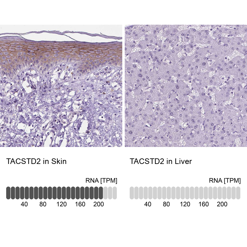 Anti-TACSTD2 Antibody