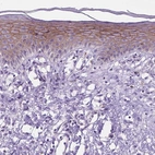 Immunohistochemical staining of human skin shows strong membranous positivity in squamous epithelial cells.