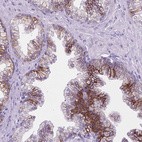Immunohistochemical staining of human prostate shows strong membranous positivity in glandular cells.