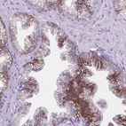 Immunohistochemical staining of human prostate shows strong membranous positivity in glandular cells.