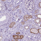 Immunohistochemical staining of human kidney shows moderate membranous positivity in cells in tubules.