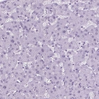 Immunohistochemical staining of human liver shows no positivity in hepatocytes, as expected.