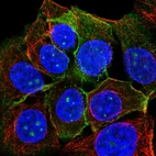 Immunofluorescent staining of human cell line MCF7 shows localization to nucleoli & plasma membrane.