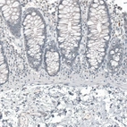 Immunohistochemical staining of human colon shows no positivity in glandular cells as expected.