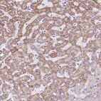 Anti-TMEM170A Antibody
