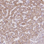 Anti-TMEM170A Antibody