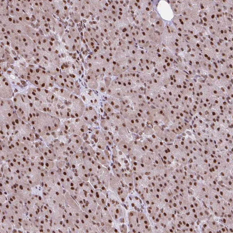 Anti-RIPK3 Antibody