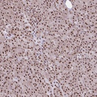 Anti-RIPK3 Antibody