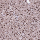 Anti-RIPK3 Antibody