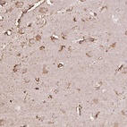 Anti-LRTM2 Antibody