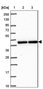 Lane 1: Marker [kDa] 250, 130, 95, 72, 55, 36, 28, 17, 10_br/_Lane 2: Human cell line RT-4_br/_Lane 3: Human cell line U-251MG sp