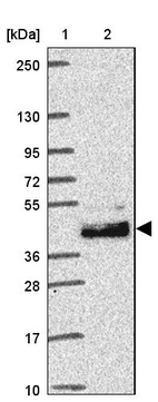 Lane 1: Marker [kDa] 250, 130, 95, 72, 55, 36, 28, 17, 10_br/_Lane 2: Human cell line RT-4