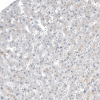 Immunohistochemical staining of human liver shows no positivity in hepatocytes as expected.