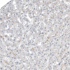 Anti-FOXL2 Antibody